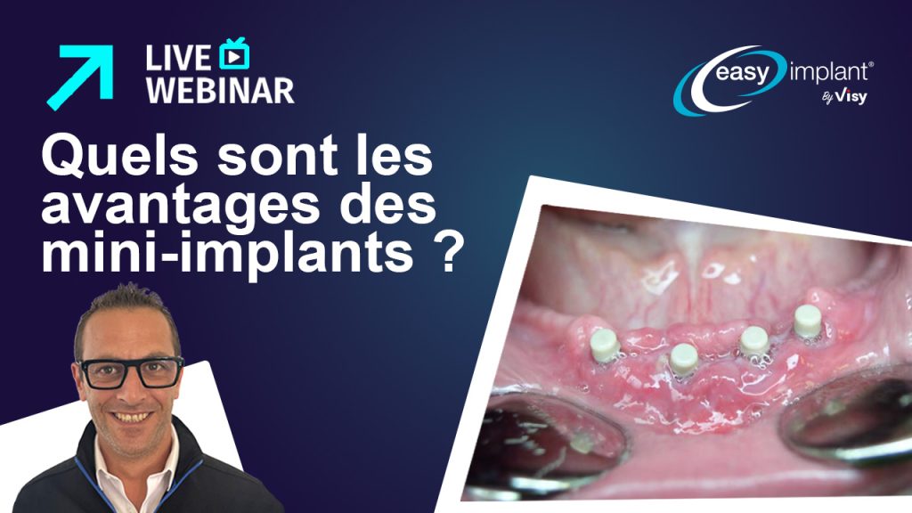 Jocelyn Carlier : Quels sont les avantages polyvalents des Mini Implants ?