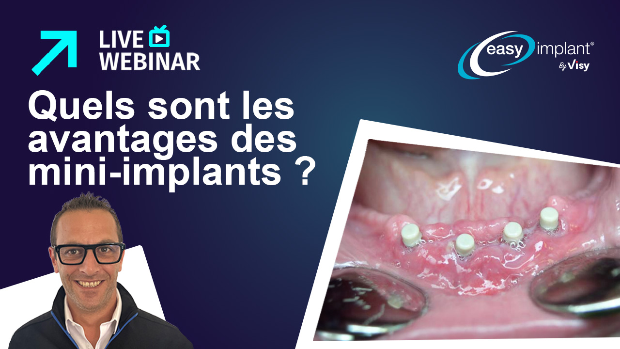 Jocelyn Carlier : Quels sont les avantages polyvalents des Mini Implants ?