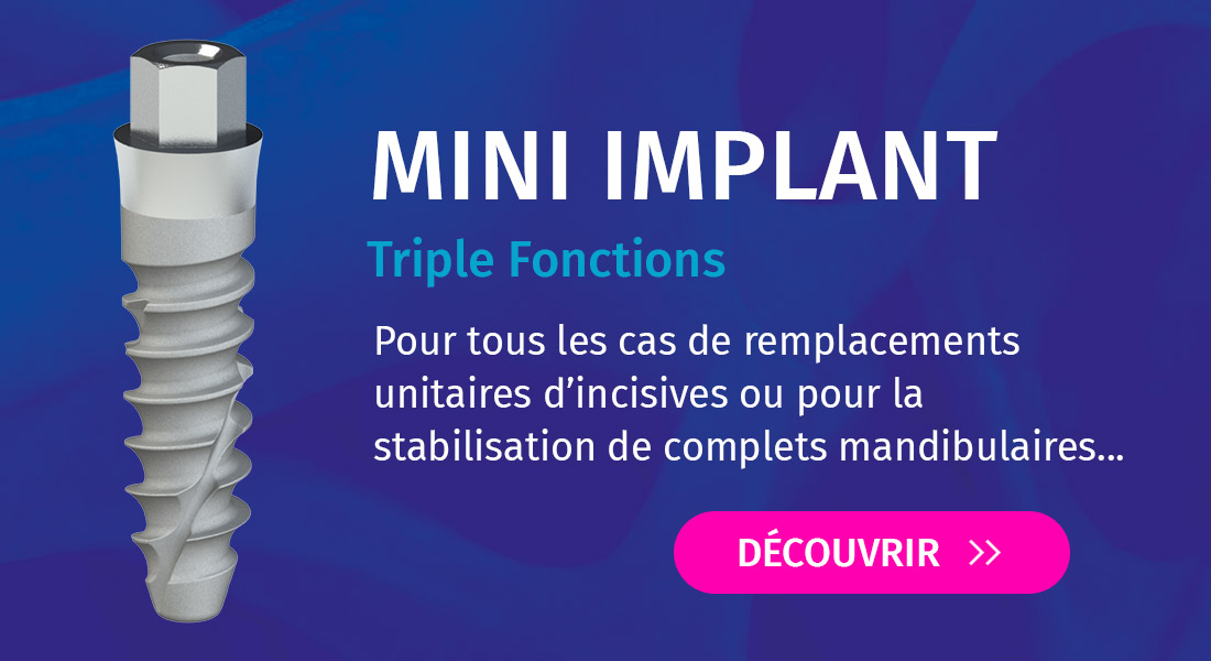 implant-mini