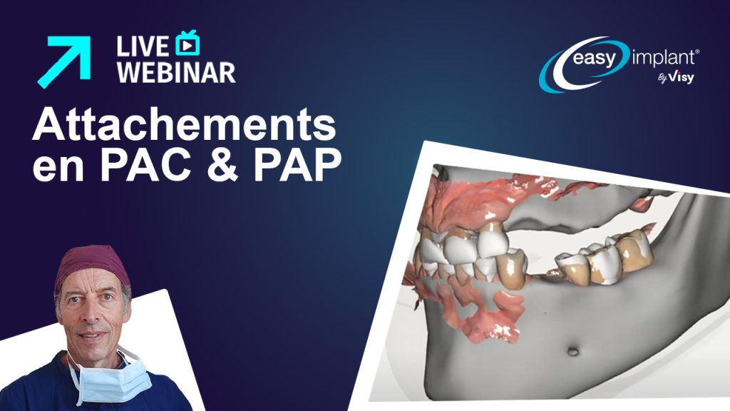Dr Niels Nevels : Attachements en PAC et PAP