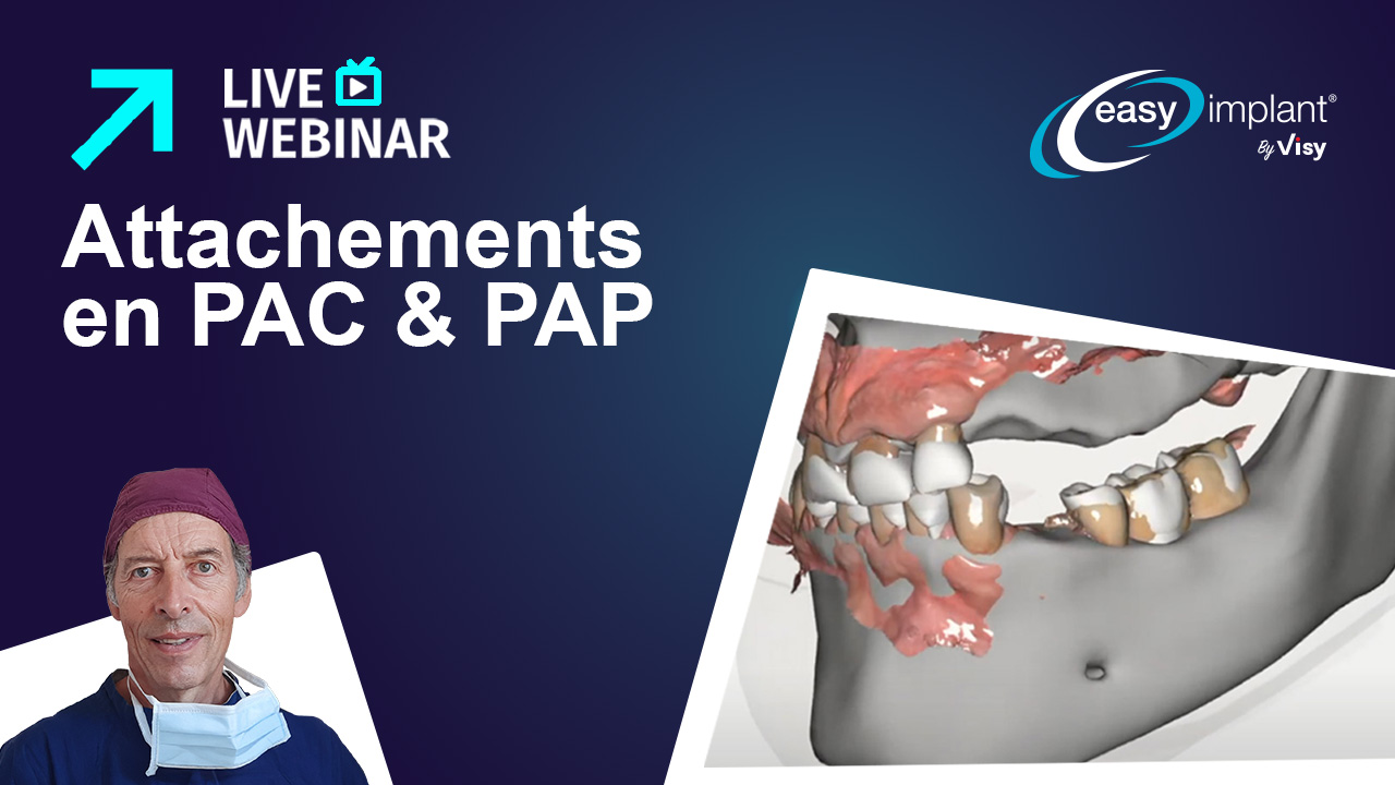 Dr Niels Nevels : Attachements en PAC et PAP